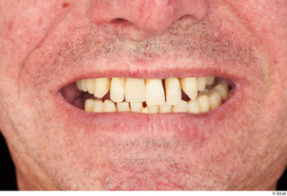 Spencer teeth 0001.jpg